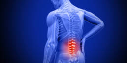 Back Pain Management