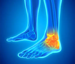 Foot and Ankle Pain Management