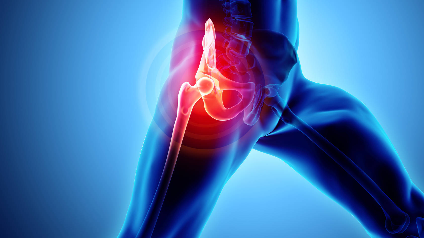Rheumatoid Arthritis Nursing Care Plans You Can Find Out More Details At The Link Of The Image Rheumatoid Arthritis Rheumatoid Arthritis Diet Knee Arthritis