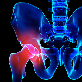 Hip Joint Pain