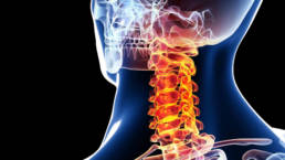 Neck Pain Treatment