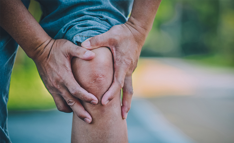 Knee Pain and Inflammation