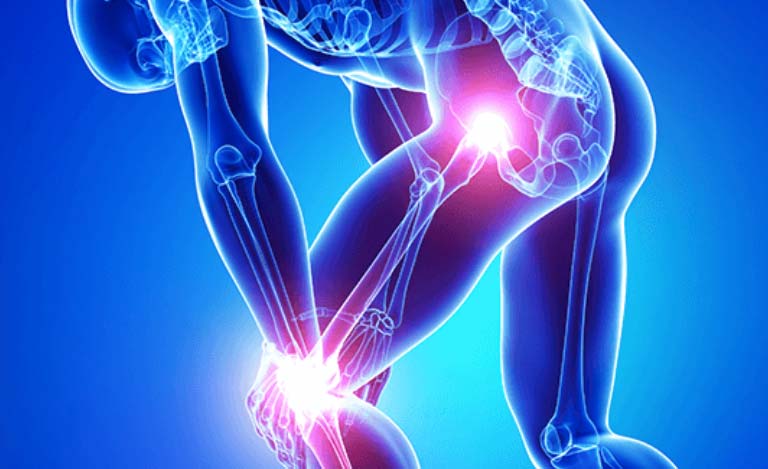 Top 5 Joint Pain Supplements